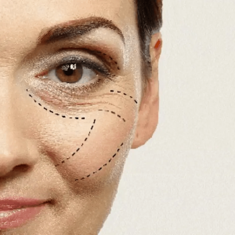 Elixir de juventud: Luce una piel firme y sin arrugas